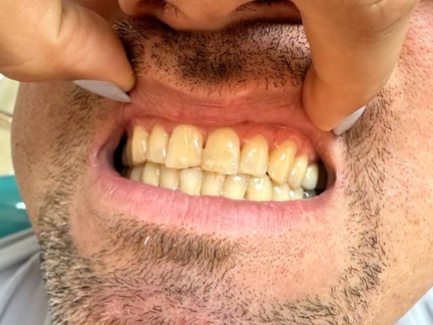 Before image